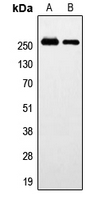 GPR179 Antibody - Western blot analysis of GPR179 expression in HeLa (A); SP2/0 (B) whole cell lysates.