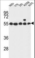 GPR180 Antibody - GPR180 Antibody western blot of WiDr,Y79,293,A2058,A375 cell line lysates (35 ug/lane). The GPR180 antibody detected the GPR180 protein (arrow).