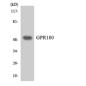 GPR180 Antibody - Western blot analysis of the lysates from Jurkat cells using GPR180 antibody.