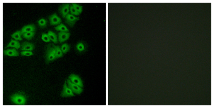 GPR180 Antibody - Immunofluorescence analysis of A549 cells, using GPR180 Antibody. The picture on the right is blocked with the synthesized peptide.