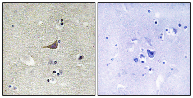 GPR180 Antibody - Immunohistochemistry analysis of paraffin-embedded human brain tissue, using GPR180 Antibody. The picture on the right is blocked with the synthesized peptide.