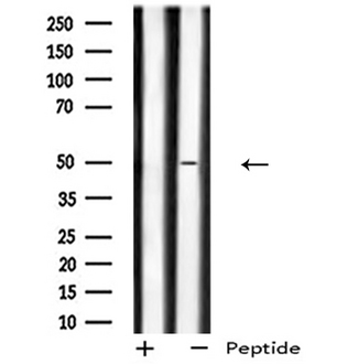 GPR180 Antibody - Western blot analysis of GPR180 expression in mouse lung lysate 