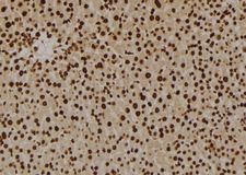 GPR180 Antibody - 1:100 staining mouse liver tissue by IHC-P. The sample was formaldehyde fixed and a heat mediated antigen retrieval step in citrate buffer was performed. The sample was then blocked and incubated with the antibody for 1.5 hours at 22°C. An HRP conjugated goat anti-rabbit antibody was used as the secondary.
