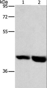 GPR182 / ADMR Antibody - Western blot analysis of Mouse heart and liver tissue, using GPR182 Polyclonal Antibody at dilution of 1:1000.