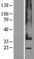 GPR182 / ADMR Protein - Western validation with an anti-DDK antibody * L: Control HEK293 lysate R: Over-expression lysate