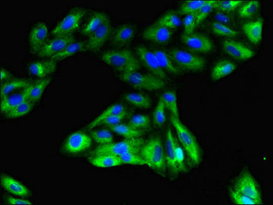 GPR183 / EBI2 Antibody - Immunofluorescent analysis of HepG2 cells using GPR183 Antibody at dilution of 1:100 and Alexa Fluor 488-congugated AffiniPure Goat Anti-Rabbit IgG(H+L)