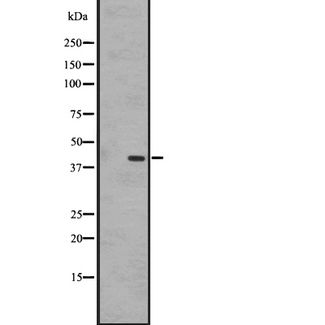 GPR183 / EBI2 Antibody - Western blot analysis of EBI2 expression in A431 whole cells lysate. The lane on the left is treated with the antigen-specific peptide.