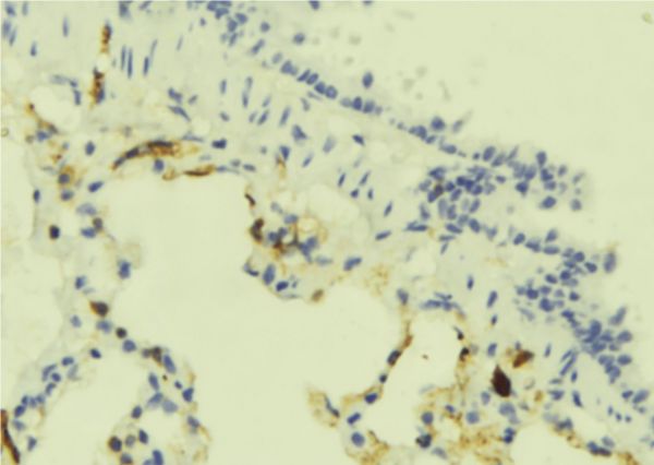 GPR183 / EBI2 Antibody - 1:100 staining mouse lung tissue by IHC-P. The sample was formaldehyde fixed and a heat mediated antigen retrieval step in citrate buffer was performed. The sample was then blocked and incubated with the antibody for 1.5 hours at 22°C. An HRP conjugated goat anti-rabbit antibody was used as the secondary.