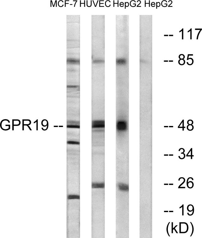 GPR19 Antibody - Western blot analysis of lysates from MCF-7, HUVEC, and HepG2 cells, using GPR19 Antibody. The lane on the right is blocked with the synthesized peptide.