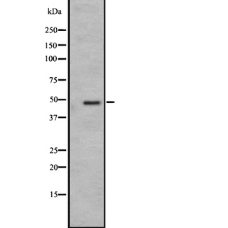 GPR19 Antibody - Western blot analysis of GPR19 expression in A431 whole cells lysate. The lane on the left is treated with the antigen-specific peptide.