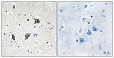 GPR20 Antibody - Peptide - + Immunohistochemistry analysis of paraffin-embedded human brain tissue using GPR20 antibody.