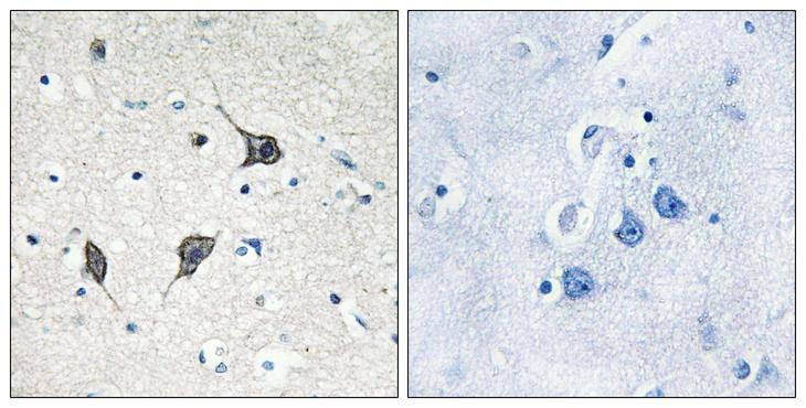 GPR20 Antibody - Peptide - + Immunohistochemistry analysis of paraffin-embedded human brain tissue using GPR20 antibody.