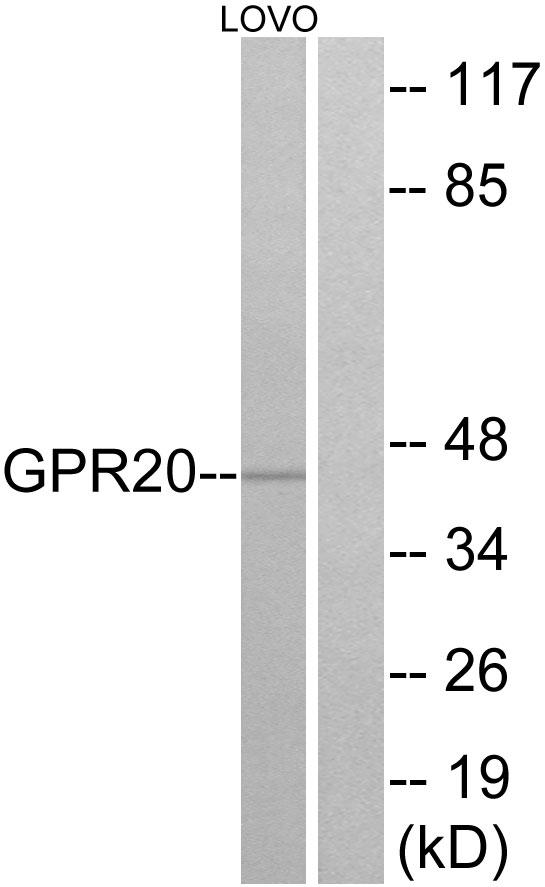 GPR20 Antibody - Western blot analysis of extracts from LOVO cells, using GPR20 antibody.