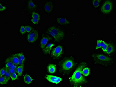 GPR21 Antibody - Immunofluorescent analysis of MCF-7 cells using GPR21 Antibody at dilution of 1:100 and Alexa Fluor 488-congugated AffiniPure Goat Anti-Rabbit IgG(H+L)