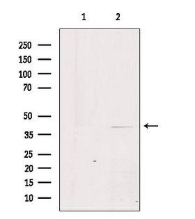GPR21 Antibody - Western blot analysis of extracts of HeLa cells using GPR21 antibody. Lane 1 was treated with the blocking peptide.