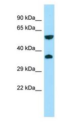 GPR22 Antibody - GPR22 antibody Western Blot of 293T.  This image was taken for the unconjugated form of this product. Other forms have not been tested.