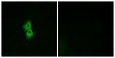 GPR22 Antibody - Immunofluorescence analysis of MCF7 cells, using GPR22 Antibody. The picture on the right is blocked with the synthesized peptide.
