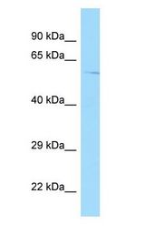 GPR22 Antibody - GPR22 antibody Western Blot of Fetal Kidney.  This image was taken for the unconjugated form of this product. Other forms have not been tested.