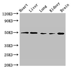 GPR22 Antibody - Positive WB detected in:Mouse heart tissue,Mouse liver tissue,Mouse lung tissue,Mouse kidney tissue,Mouse brain tissue;All lanes:GPR22 antibody at 2.5?g/ml;Secondary;Goat polyclonal to rabbit IgG at 1/50000 dilution;Predicted band size: 50 KDa;Observed band size: 50 KDa;