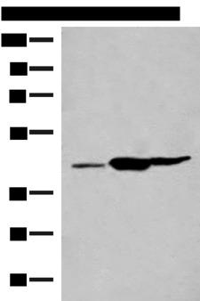 GPR22 Antibody - Western blot analysis of Mouse liver tissue Mouse kidney tissue Rat brain tissue lysates  using GPR22 Polyclonal Antibody at dilution of 1:500