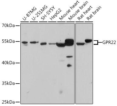 GPR22 Antibody - Western blot analysis of extracts of various cell lines using GPR22 Polyclonal Antibody at dilution of 1:1000.