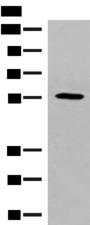 GPR22 Antibody - Western blot analysis of HepG2 cell lysate  using GPR22 Polyclonal Antibody at dilution of 1:500