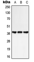 GPR25 Antibody - Western blot analysis of GPR25 expression in HeLa (A); NIH3T3 (B); rat spleen (C) whole cell lysates.