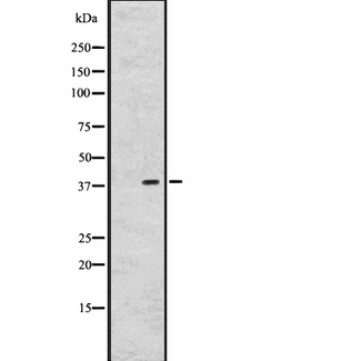GPR26 Antibody - Western blot analysis of GPR26 expression in A431 whole cells lysate. The lane on the left is treated with the antigen-specific peptide.