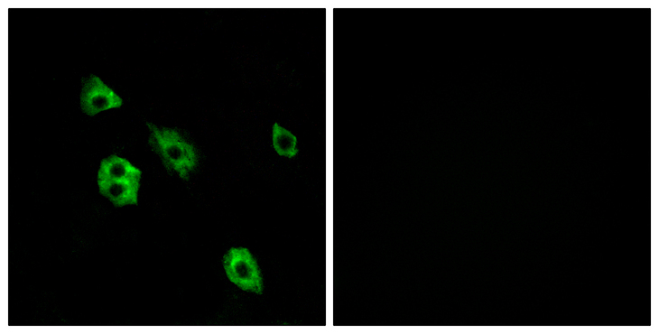 GPR27 Antibody - Immunofluorescence analysis of A549 cells, using GPR27 Antibody. The picture on the right is blocked with the synthesized peptide.