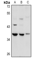 GPR27 Antibody - Western blot analysis of GPR27 expression in HEK293T (A), SGC7901 (B), mouse lung (C) whole cell lysates.