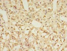 GPR3 Antibody - Immunohistochemistry of paraffin-embedded human adrenal gland tissue using antibody at 1:100 dilution.