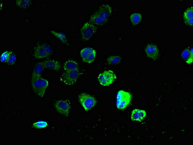 GPR3 Antibody - Immunofluorescent analysis of MCF-7 cells using GPR3 Antibody at dilution of 1:100 and Alexa Fluor 488-congugated AffiniPure Goat Anti-Rabbit IgG(H+L)