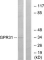 GPR31 Antibody - Western blot analysis of lysates from COLO cells, using GPR31 Antibody. The lane on the right is blocked with the synthesized peptide.