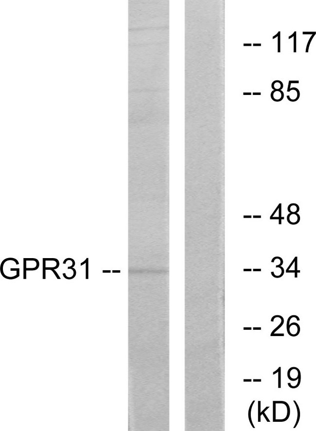 GPR31 Antibody - Western blot analysis of lysates from COLO cells, using GPR31 Antibody. The lane on the right is blocked with the synthesized peptide.