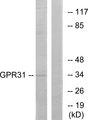 GPR31 Antibody - Western blot analysis of extracts from COLO cells, using GPR31 antibody.