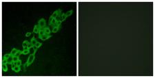 GPR32 Antibody - Immunofluorescence analysis of A549 cells, using GPR32 Antibody. The picture on the right is blocked with the synthesized peptide.