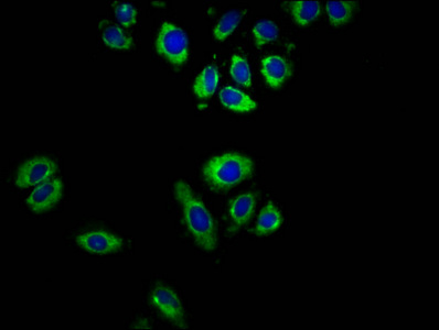 GPR32 Antibody - Immunofluorescence staining of A549 cells at a dilution of 1:166, counter-stained with DAPI. The cells were fixed in 4% formaldehyde, permeabilized using 0.2% Triton X-100 and blocked in 10% normal Goat Serum. The cells were then incubated with the antibody overnight at 4°C.The secondary antibody was Alexa Fluor 488-congugated AffiniPure Goat Anti-Rabbit IgG (H+L) .