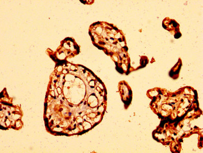 GPR32 Antibody - Immunohistochemistry image at a dilution of 1:500 and staining in paraffin-embedded human placenta tissue performed on a Leica BondTM system. After dewaxing and hydration, antigen retrieval was mediated by high pressure in a citrate buffer (pH 6.0) . Section was blocked with 10% normal goat serum 30min at RT. Then primary antibody (1% BSA) was incubated at 4 °C overnight. The primary is detected by a biotinylated secondary antibody and visualized using an HRP conjugated SP system.