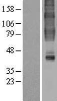 GPR32 Protein - Western validation with an anti-DDK antibody * L: Control HEK293 lysate R: Over-expression lysate