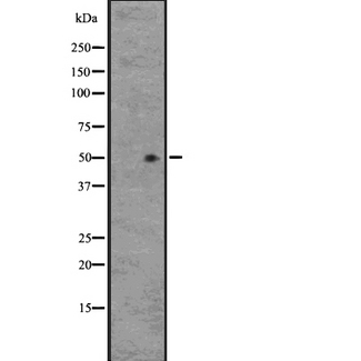 GPR33 Antibody - Western blot analysis of GPR33 expression in HEK293 cells. The lane on the left is treated with the antigen-specific peptide.