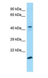 GPR34 Antibody - GPR34 antibody Western Blot of 293T.  This image was taken for the unconjugated form of this product. Other forms have not been tested.