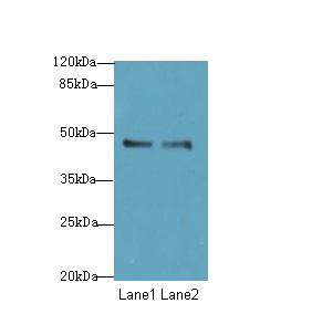 GPR34 Antibody - Western blot. All lanes: GPR34 antibody at 8 ug/ml. Lane 1: Mouse liver tissue. Lane 2: Mouse kidney tissue. Secondary Goat polyclonal to Rabbit IgG at 1:10000 dilution. Predicted band size: 44 kDa. Observed band size: 44 kDa.