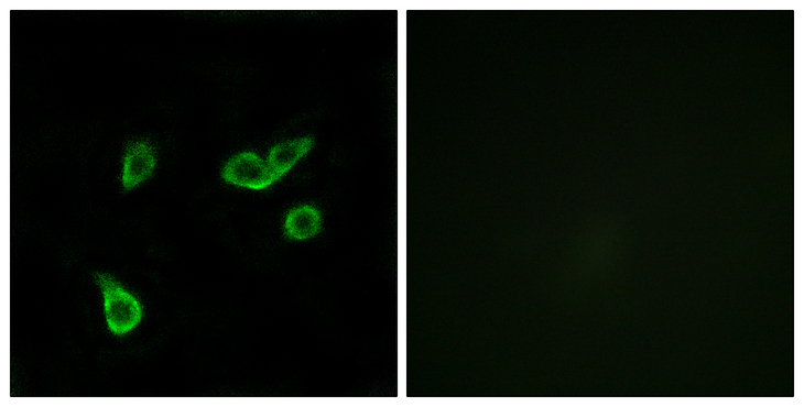 GPR35 Antibody - Immunofluorescence analysis of A549 cells, using GPR35 Antibody. The picture on the right is blocked with the synthesized peptide.