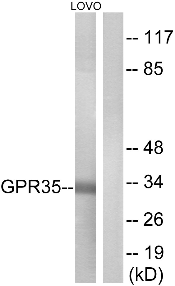 GPR35 Antibody - Western blot analysis of lysates from LOVO cells, using GPR35 Antibody. The lane on the right is blocked with the synthesized peptide.