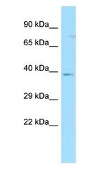 GPR35 Antibody - GPR35 antibody Western Blot of MCF7.  This image was taken for the unconjugated form of this product. Other forms have not been tested.