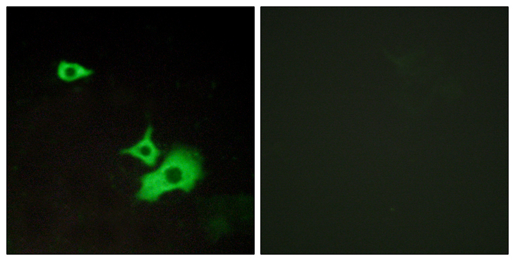 GPR37L1 Antibody - Immunofluorescence analysis of LOVO cells, using ETBR2 Antibody. The picture on the right is blocked with the synthesized peptide.