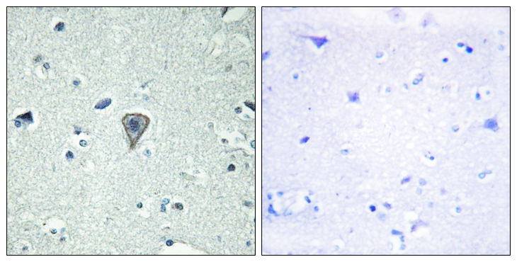 GPR37L1 Antibody - Immunohistochemistry analysis of paraffin-embedded human brain tissue, using ETBR2 Antibody. The picture on the right is blocked with the synthesized peptide.