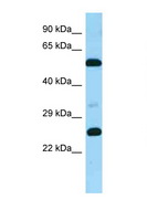 GPR37L1 Antibody - GPR37L1 antibody Western blot of Fetal Brain lysate. Antibody concentration 1 ug/ml.  This image was taken for the unconjugated form of this product. Other forms have not been tested.