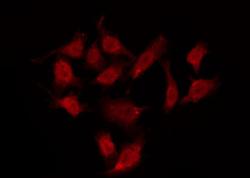 GPR37L1 Antibody - Staining HepG2 cells by IF/ICC. The samples were fixed with PFA and permeabilized in 0.1% Triton X-100, then blocked in 10% serum for 45 min at 25°C. The primary antibody was diluted at 1:200 and incubated with the sample for 1 hour at 37°C. An Alexa Fluor 594 conjugated goat anti-rabbit IgG (H+L) Ab, diluted at 1/600, was used as the secondary antibody.