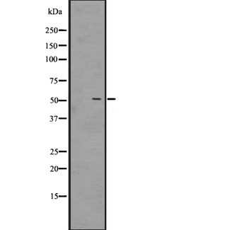 GPR39 Antibody - Western blot analysis of GPR39 expression in HEK293 cells. The lane on the left is treated with the antigen-specific peptide.